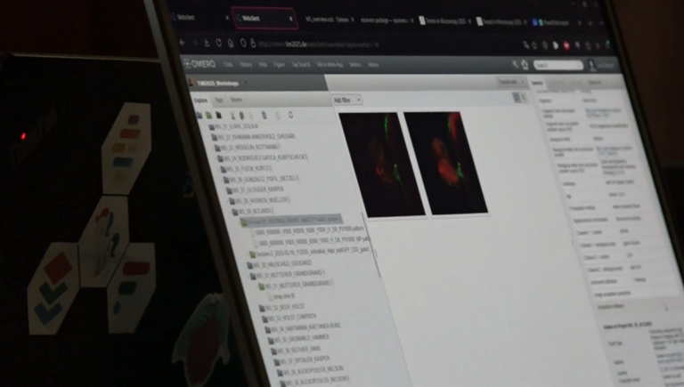 Picture of a Laptop Screen displaying the software OMERO