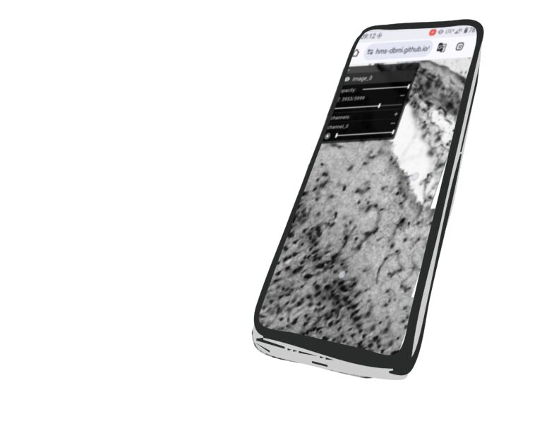 Mobile phone with big imaging data open