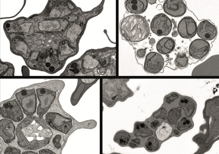 Four grayscale images of cells arranged in a grid.